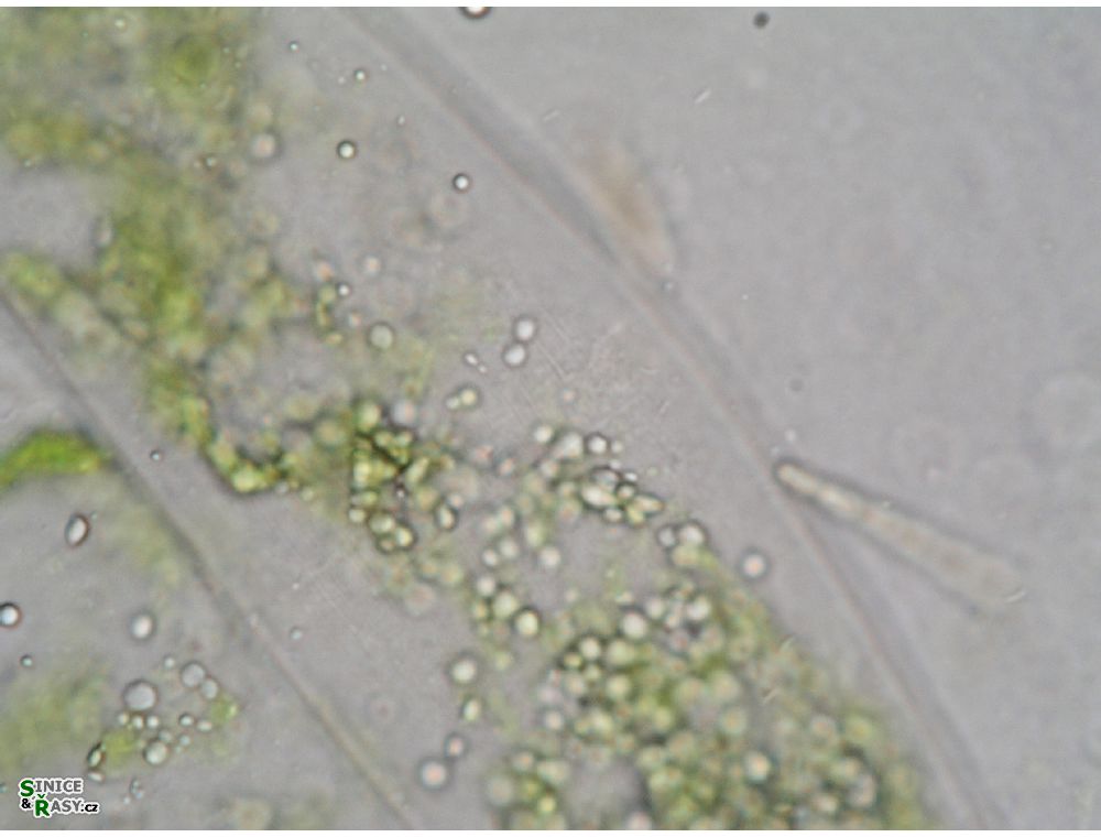 Closterium sublaterale