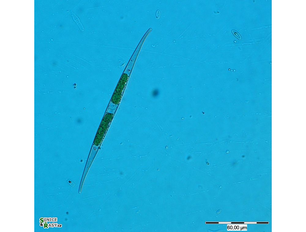 Closterium subulatum