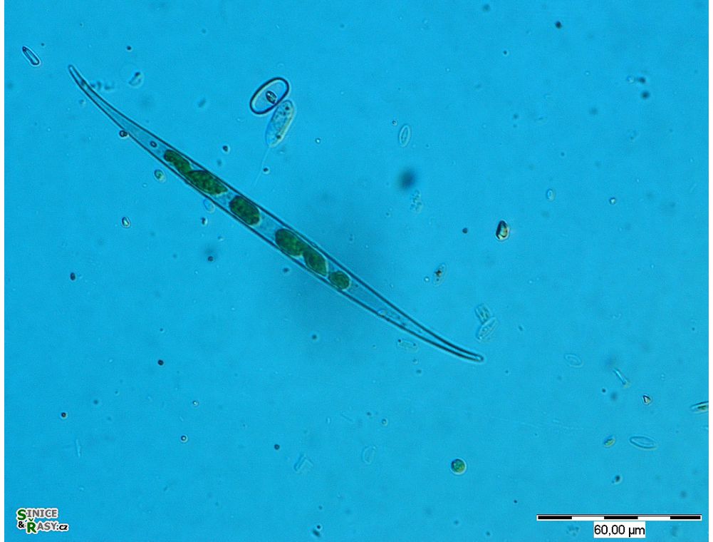 Closterium subulatum