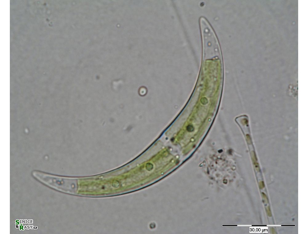 Closterium tumidulum