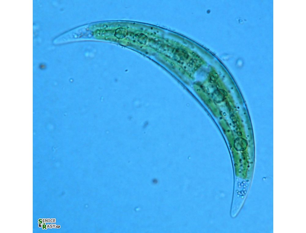 Closterium tumidulum