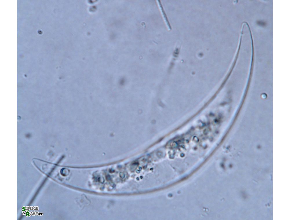 Closterium tumidulum