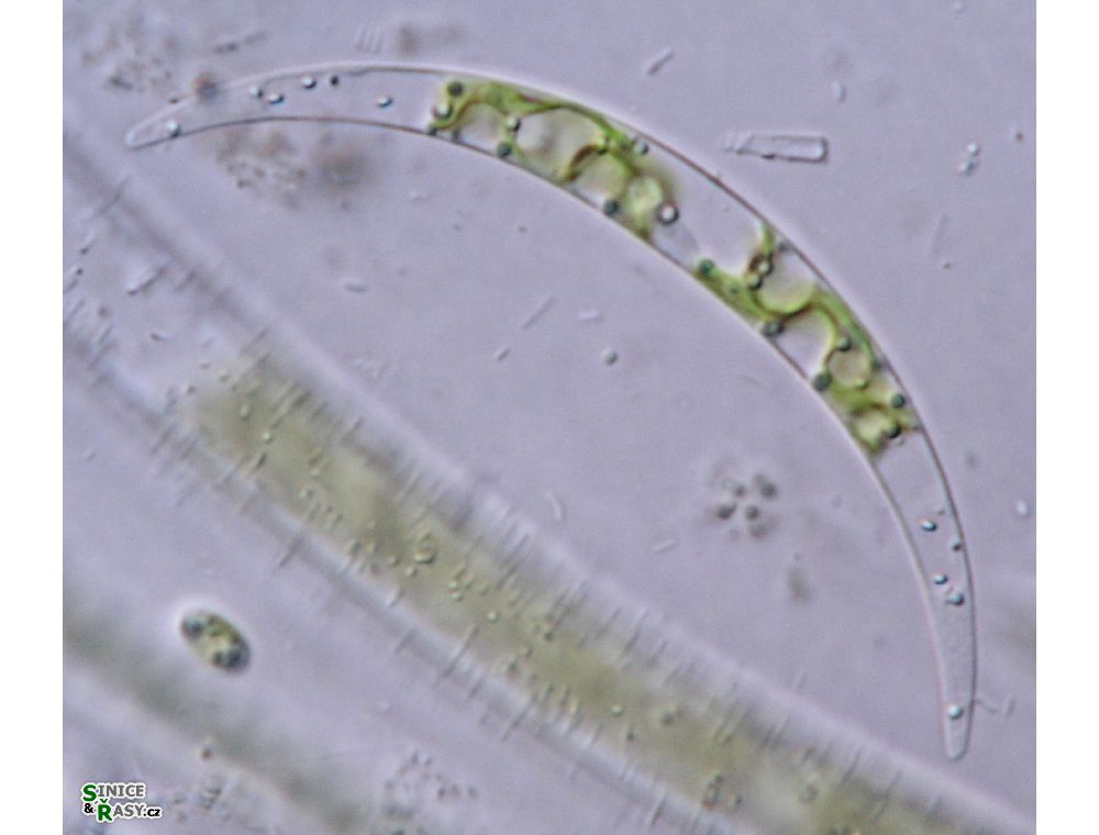 Closterium venus