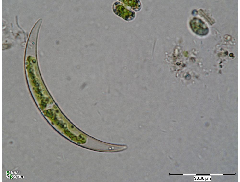 Closterium venus