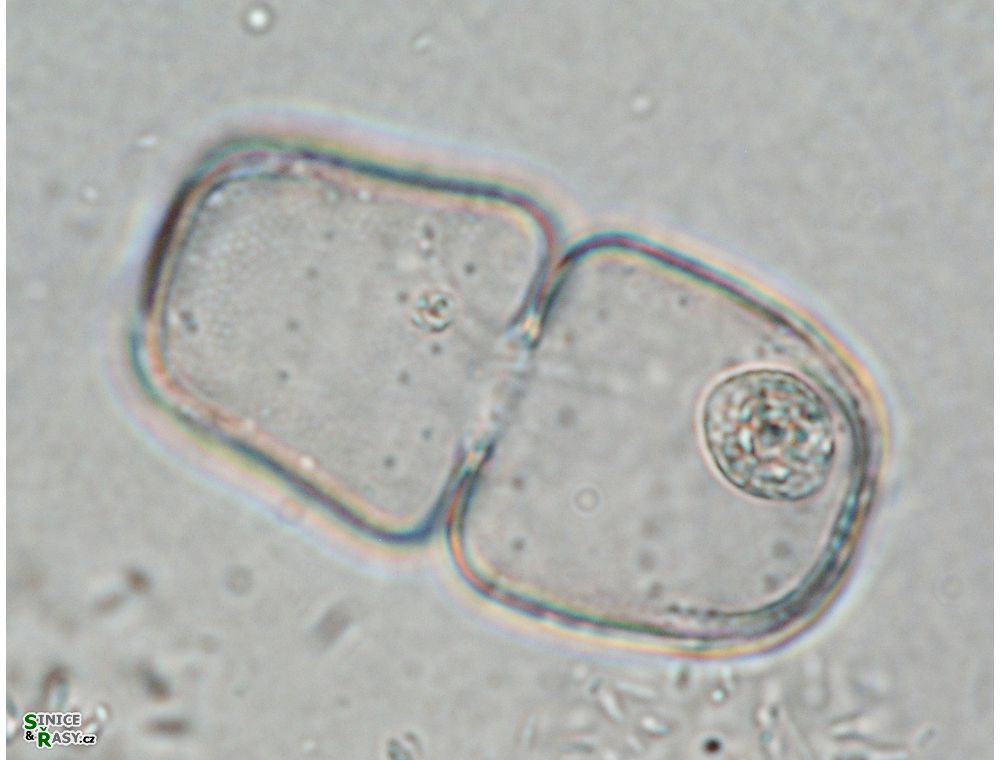 Cosmarium binerve