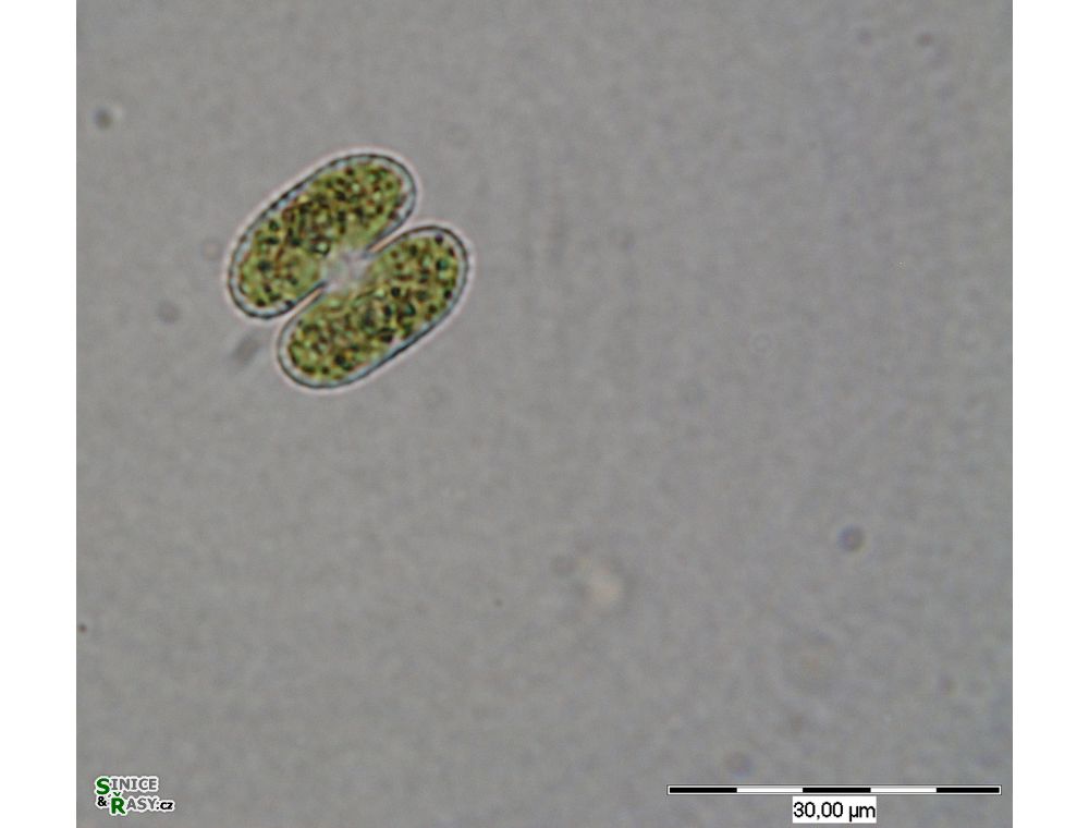 Cosmarium bioculatum