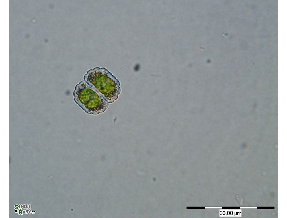 Cosmarium blytii