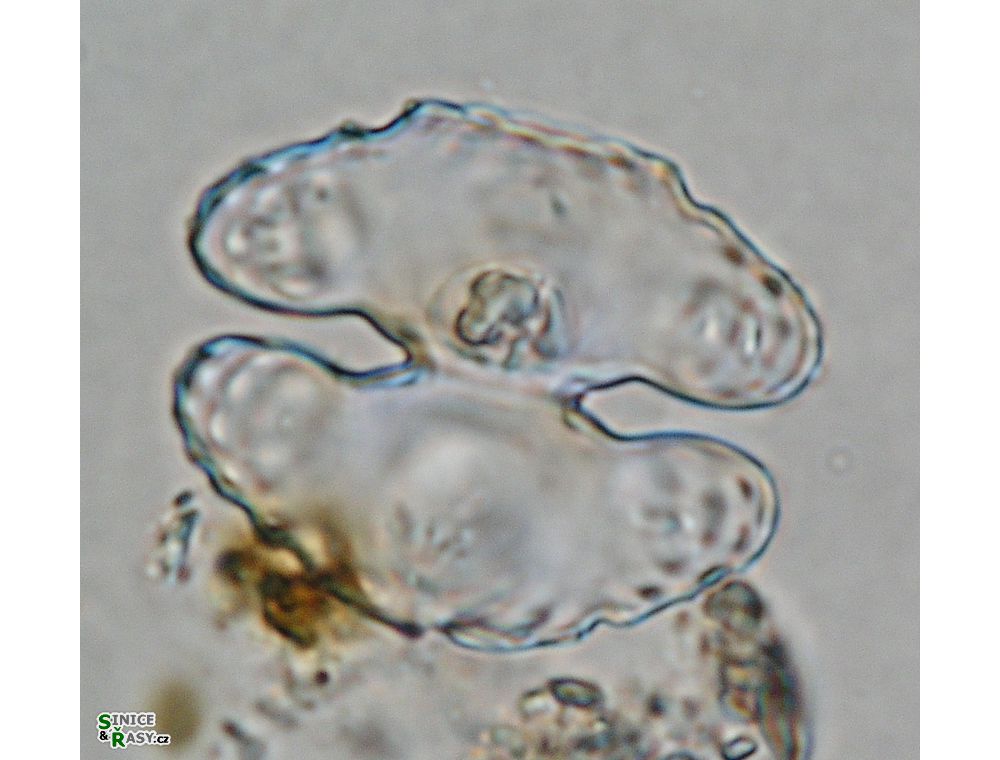 Cosmarium commissurale