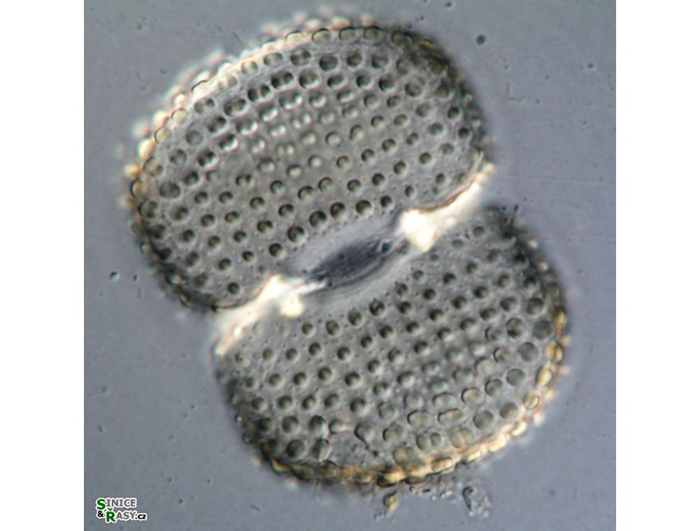 Cosmarium conspersum