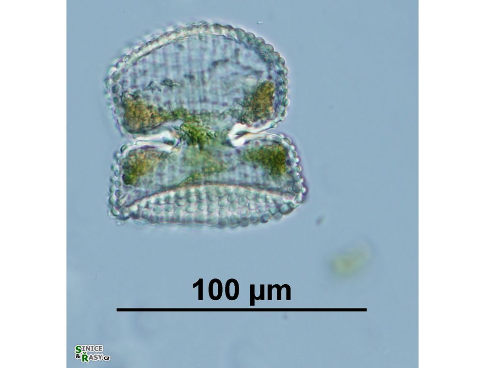 Cosmarium conspersum
