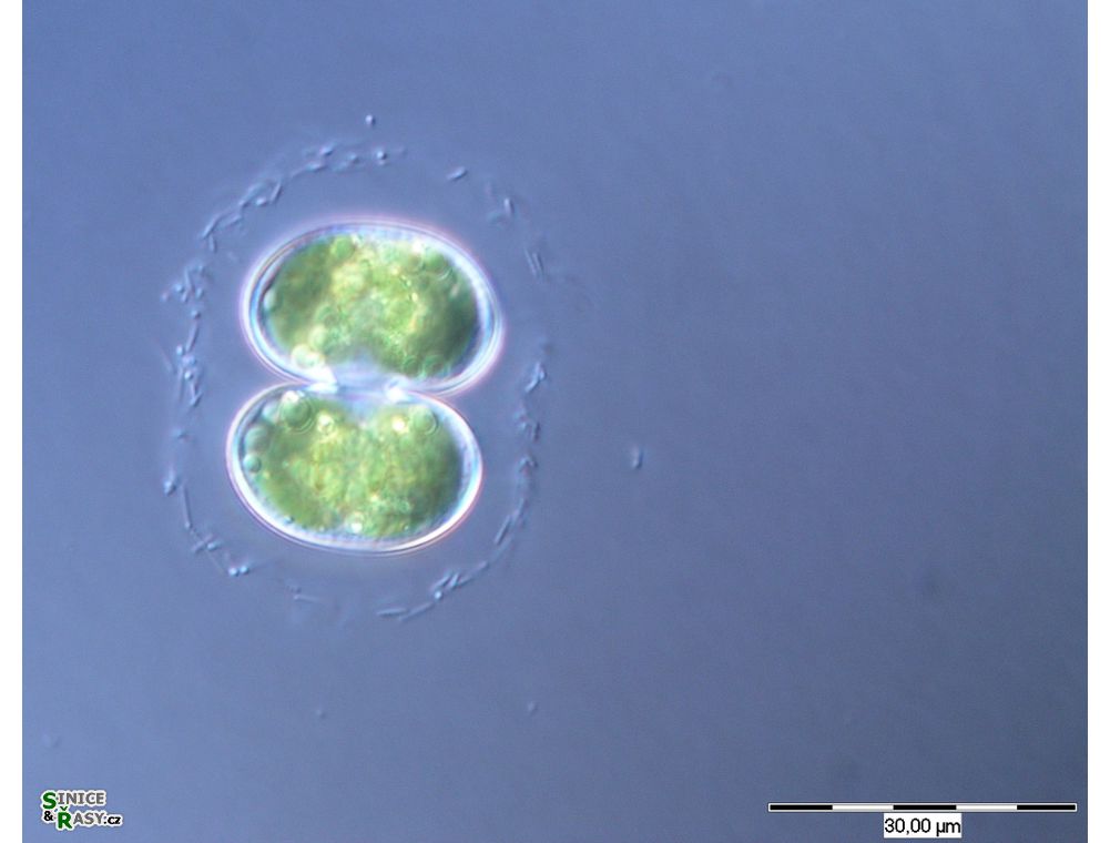 Cosmarium contractum