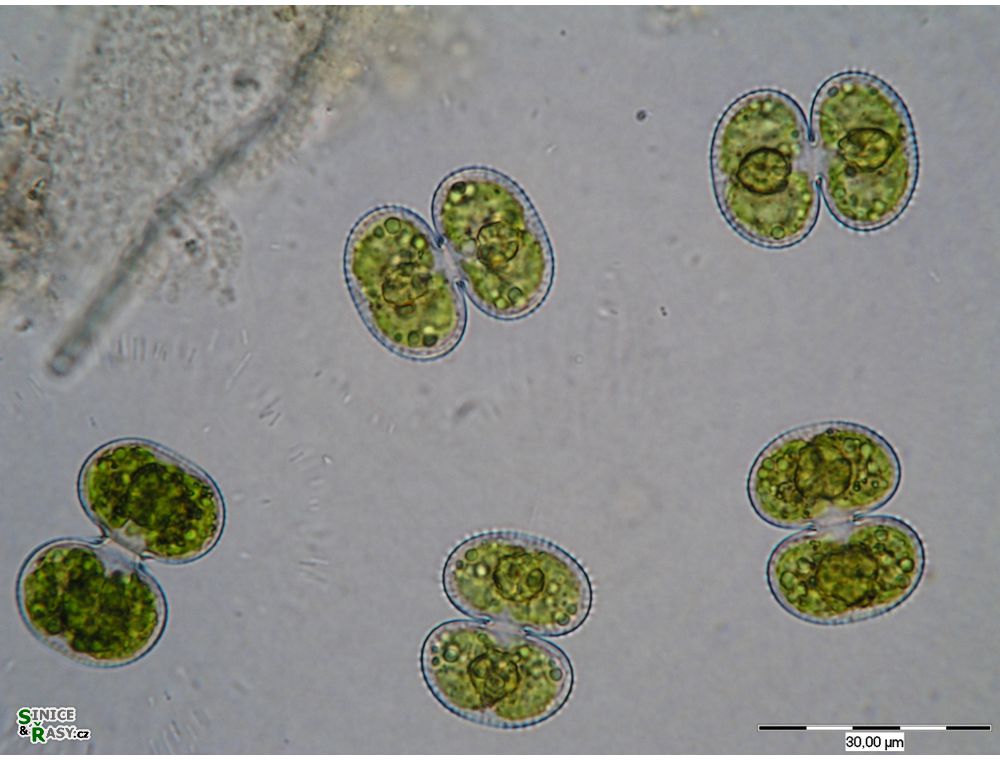 Cosmarium contractum