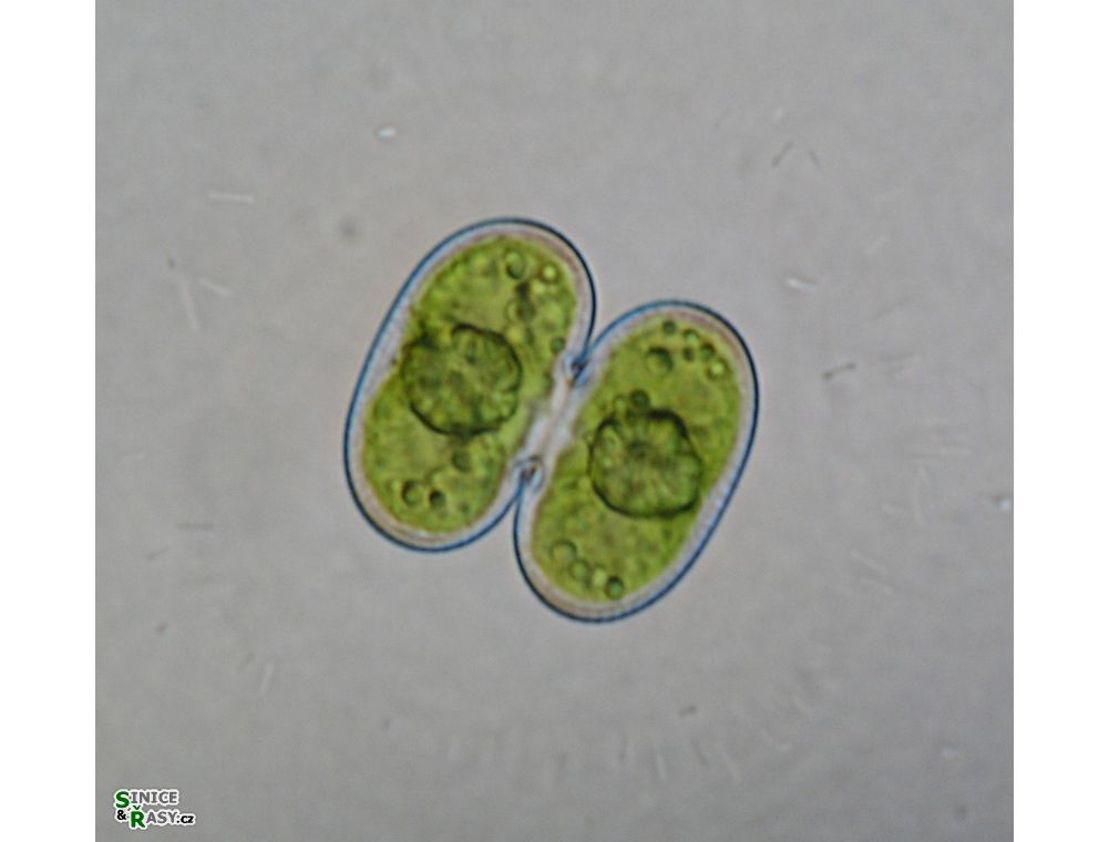 Cosmarium contractum