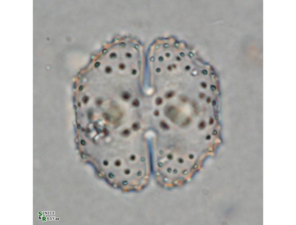 Cosmarium corbula