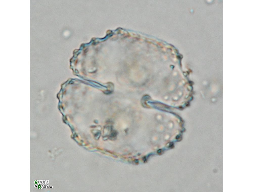 Cosmarium corbula