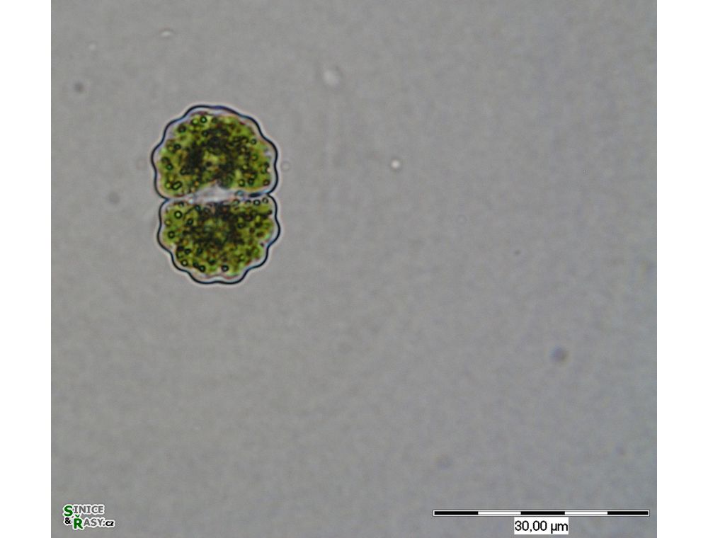 Cosmarium crenulatum