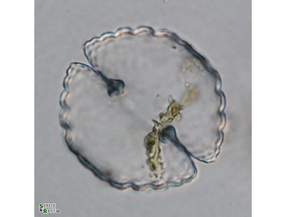 Cosmarium cyclicum