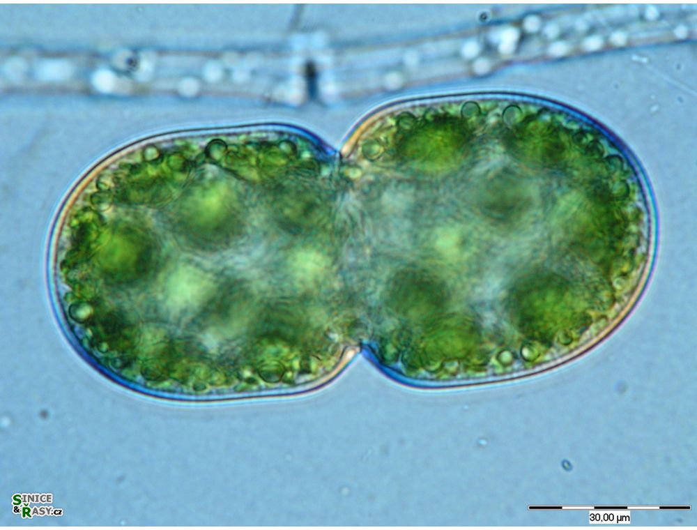 Cosmarium debaryi
