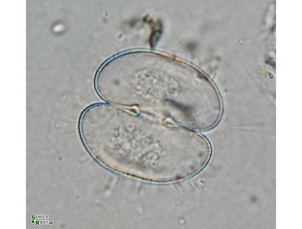 Cosmarium depressum