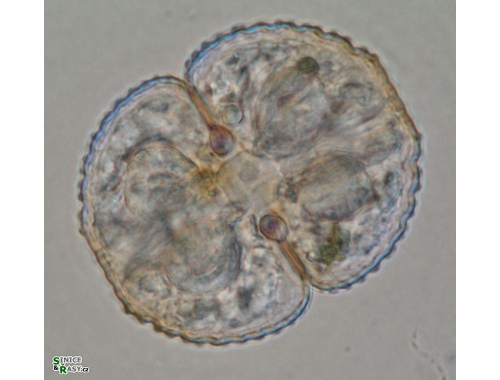 Cosmarium didymoprotupsum