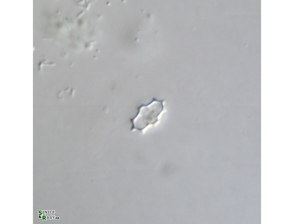 Cosmarium dilatatum