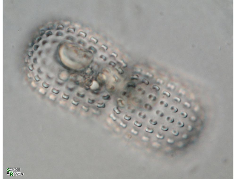 Cosmarium elegantissimum
