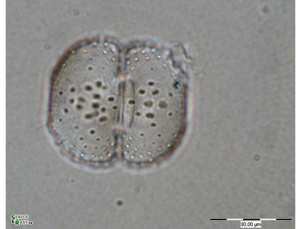 Cosmarium fastidiosum