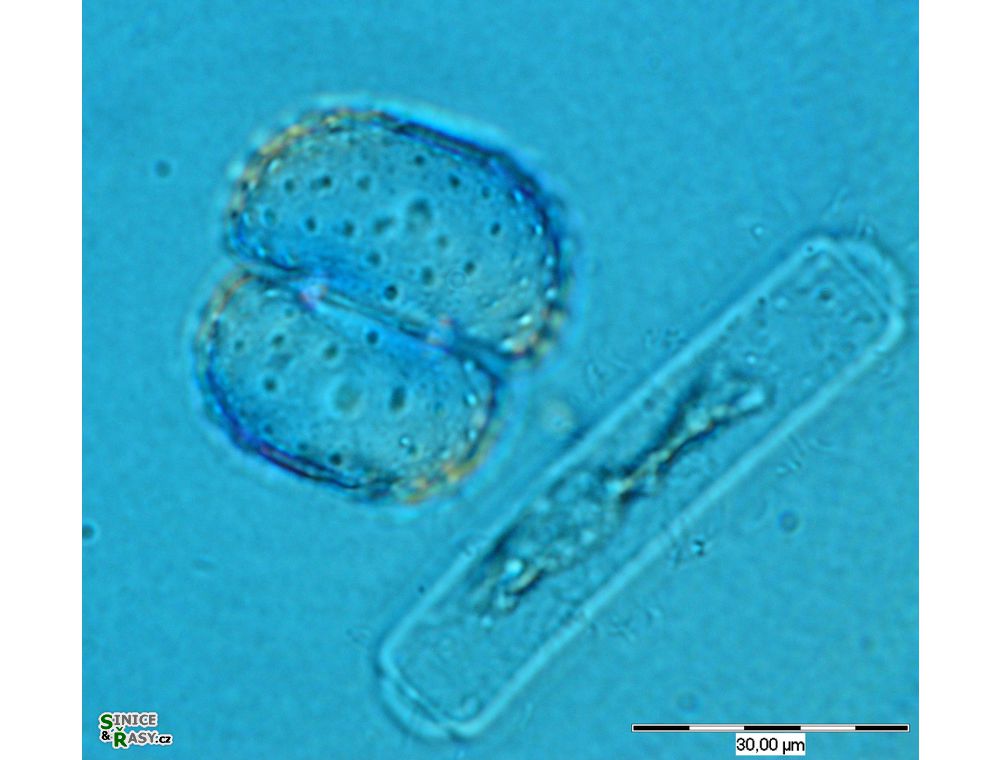 Cosmarium fastidiosum