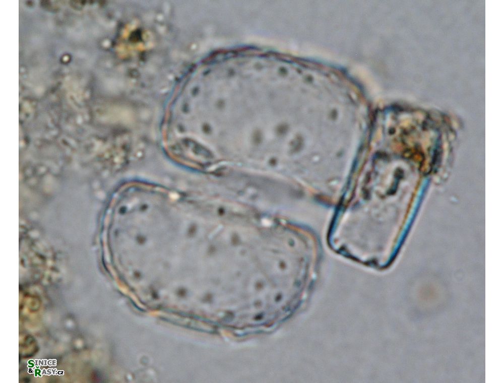 Cosmarium fastidiosum
