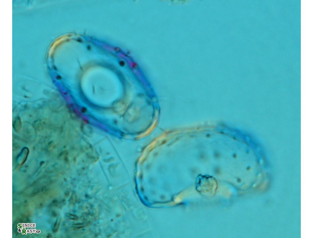 Cosmarium fastidiosum
