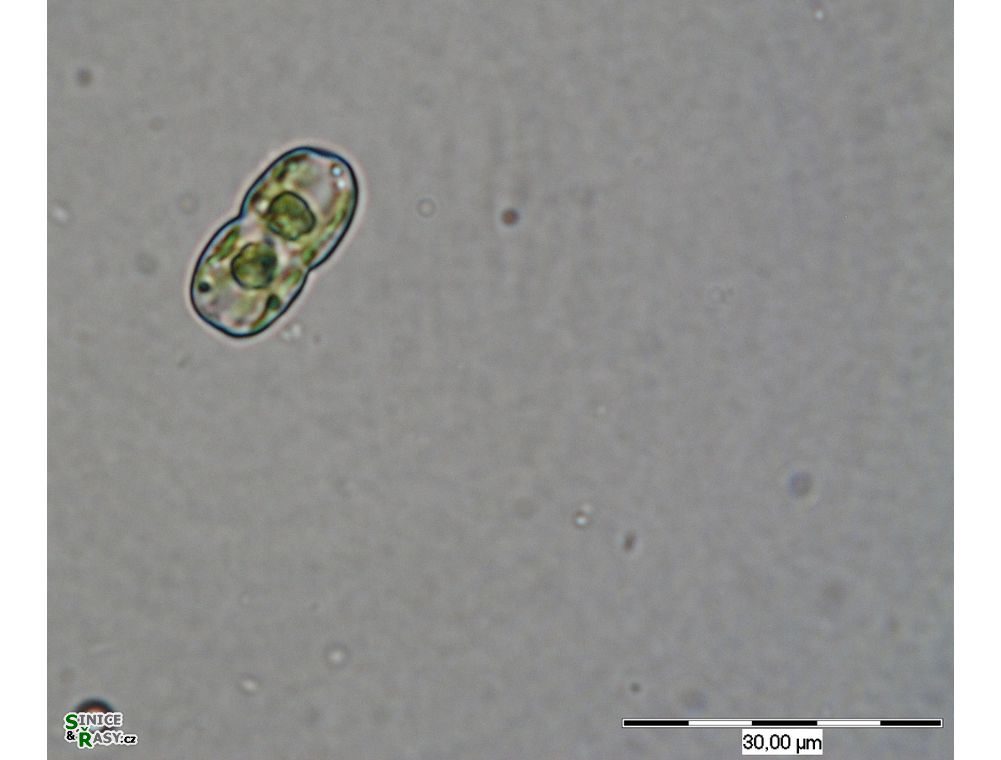 Cosmarium gonoides