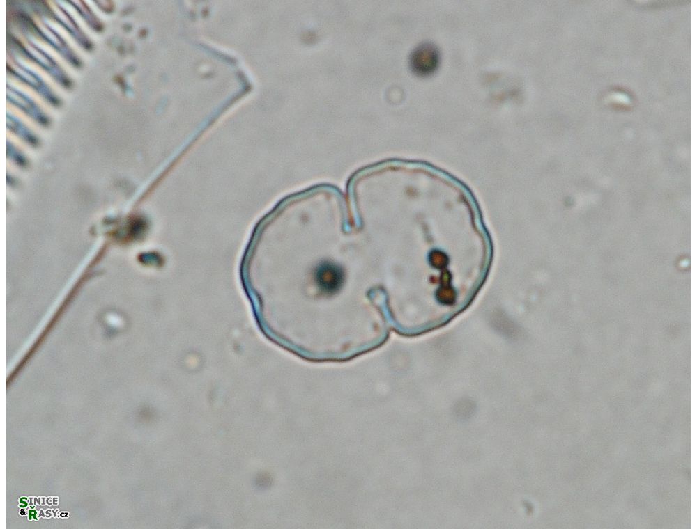 Cosmarium impressulum