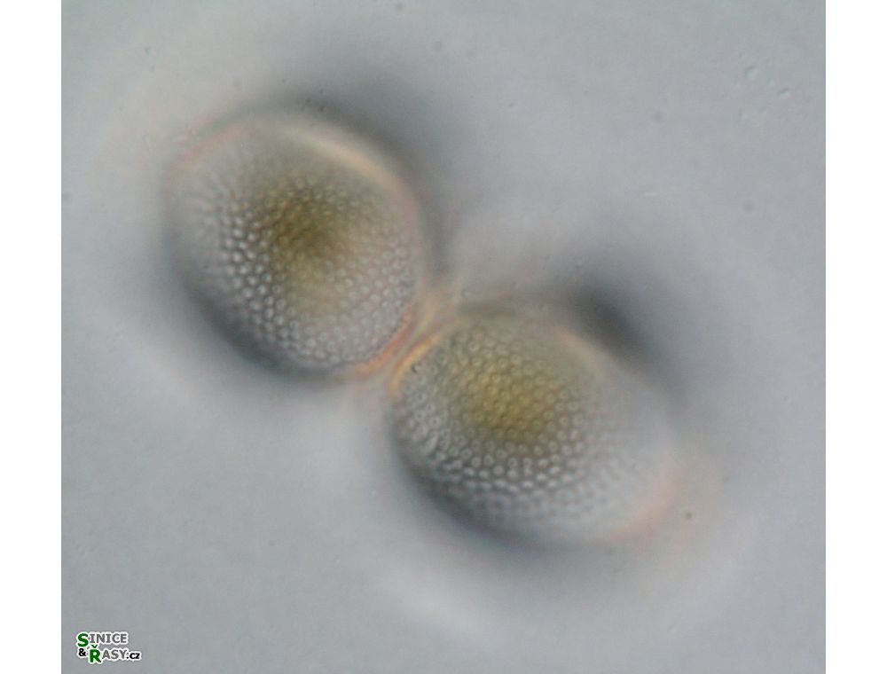 Cosmarium incrassatum