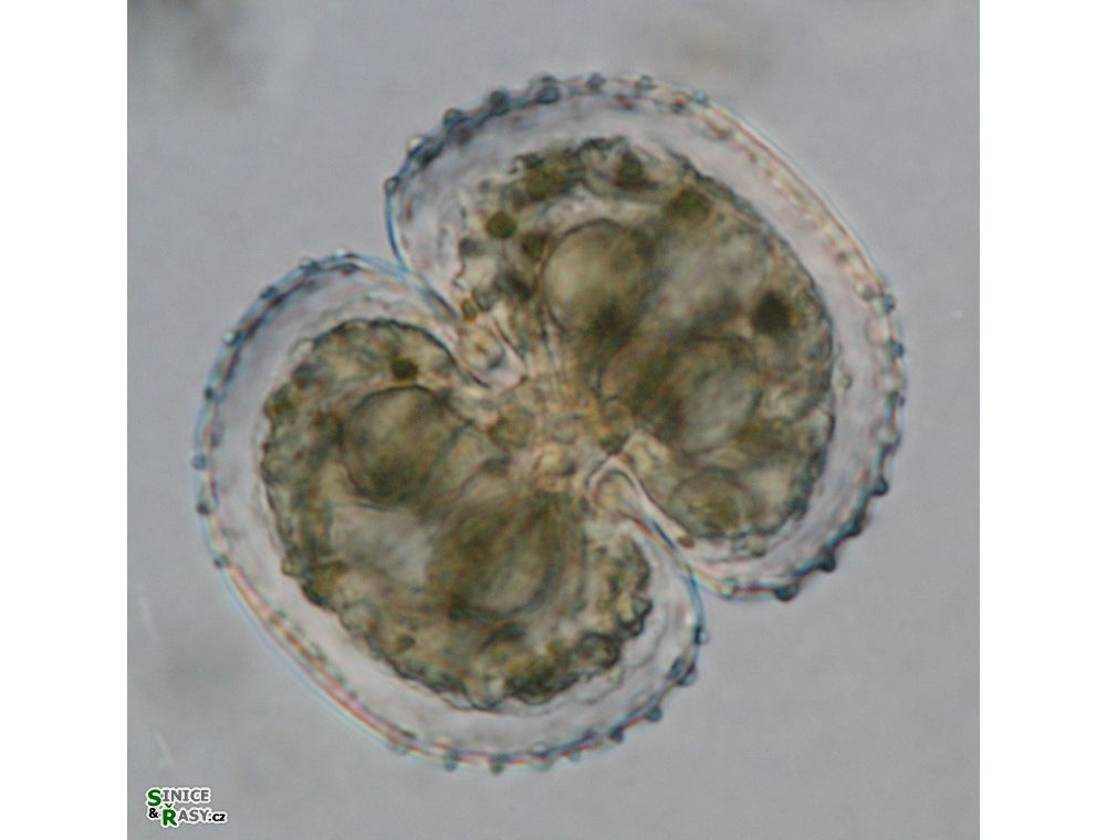 Cosmarium kirchneri