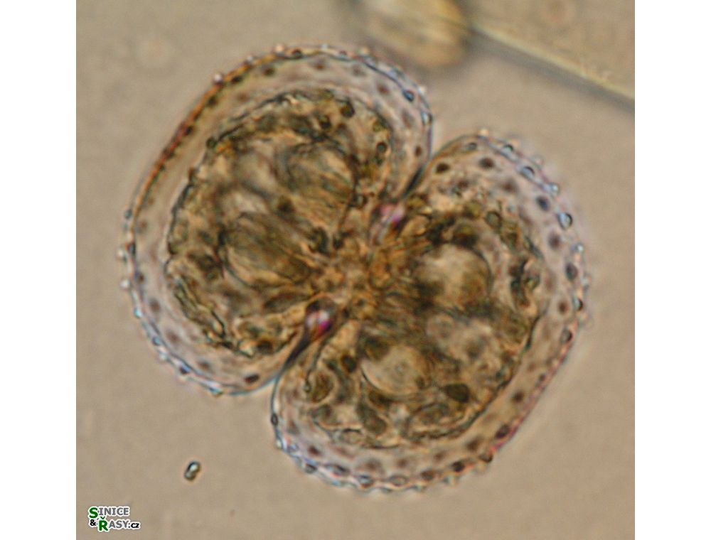 Cosmarium kirchneri