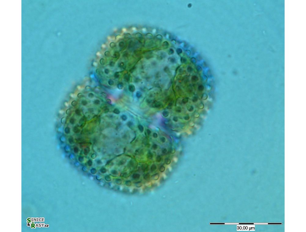 Cosmarium margaritatum