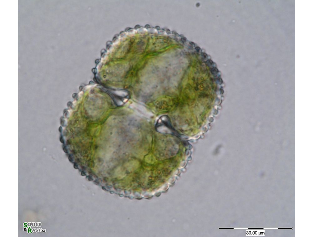 Cosmarium margaritatum