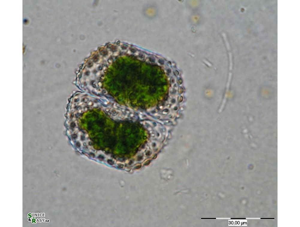 Cosmarium margaritiferum