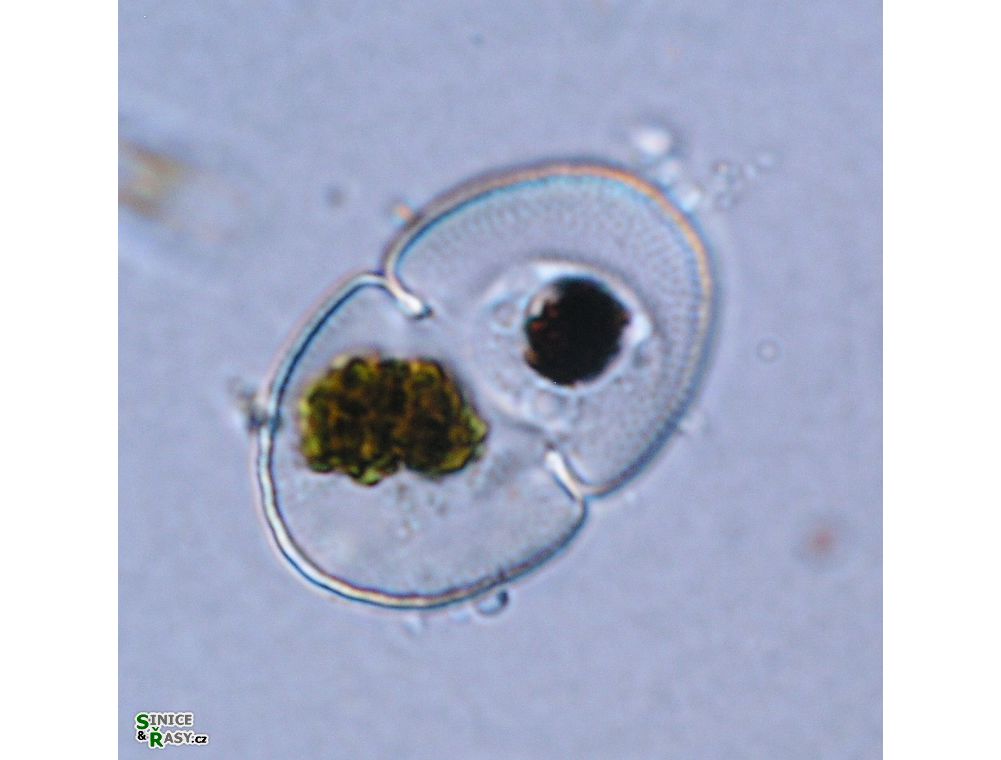 Cosmarium microsphinctum