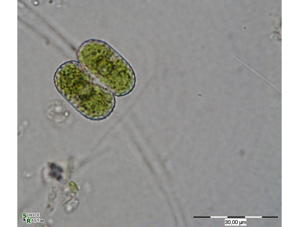 Cosmarium notatum