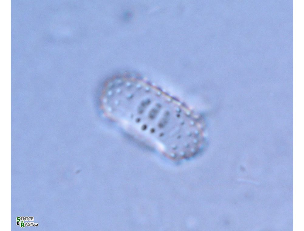 Cosmarium notatum