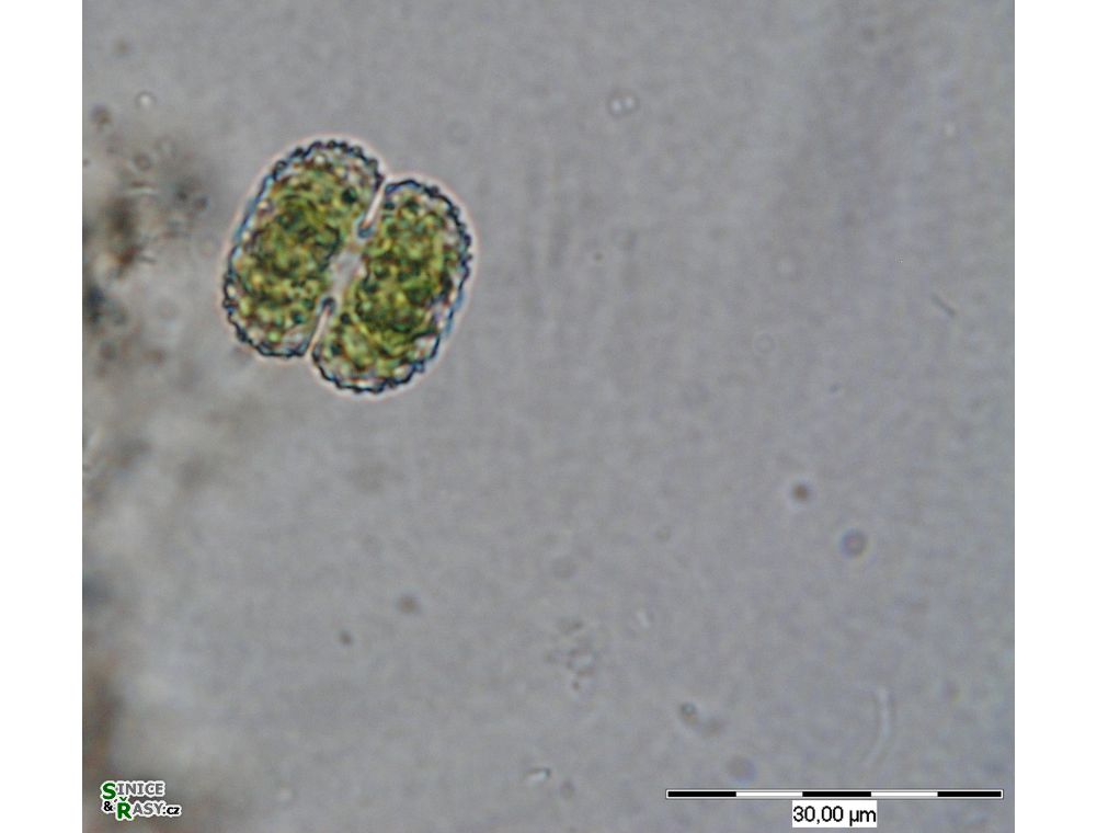 Cosmarium ordinatum