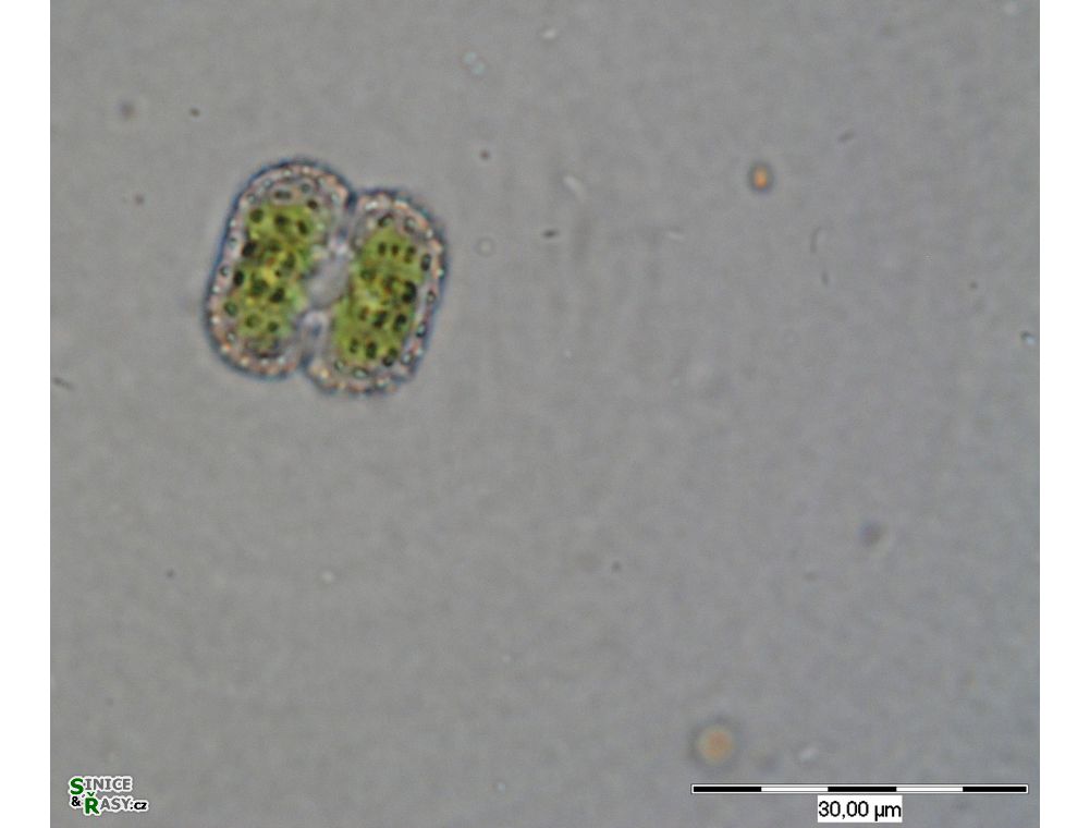 Cosmarium ordinatum