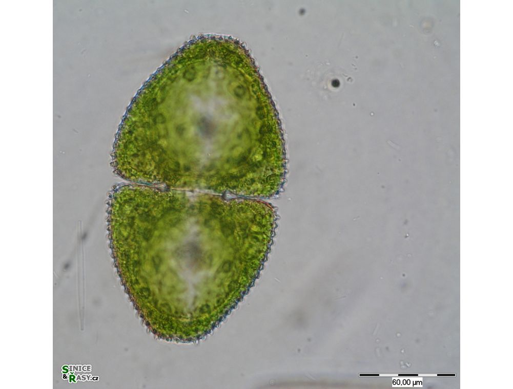 Cosmarium ovale