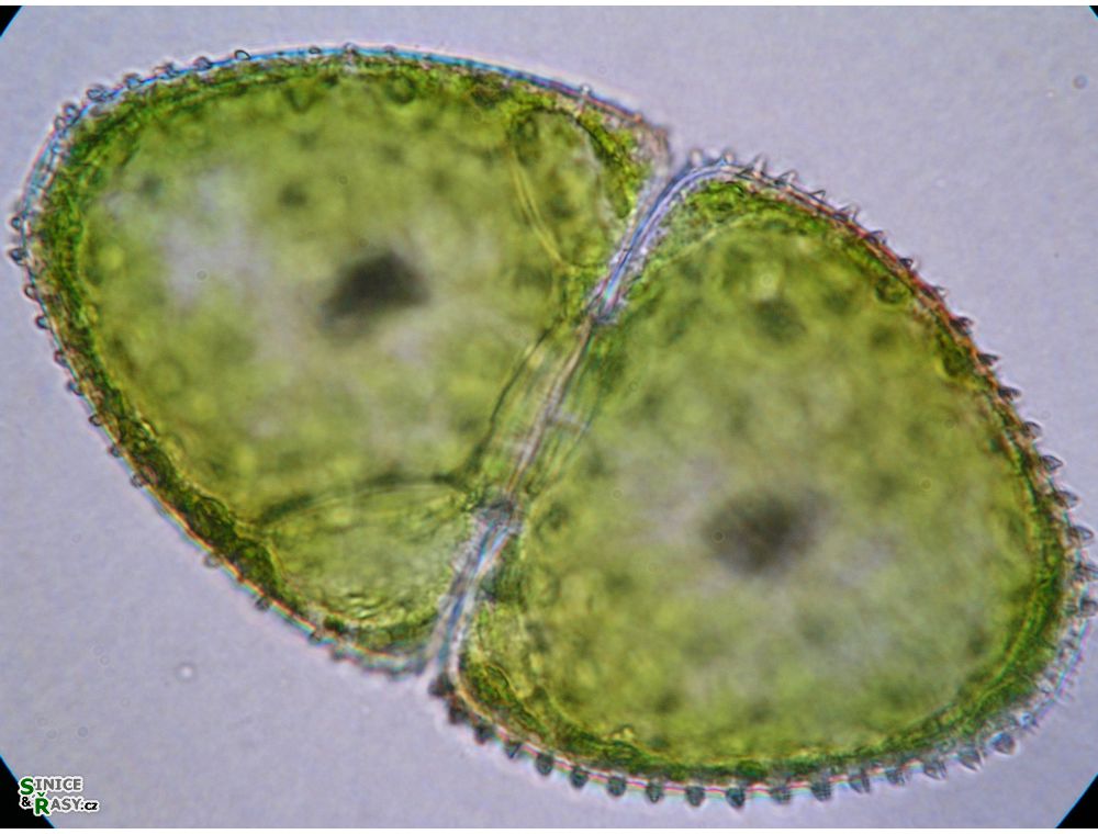 Cosmarium ovale