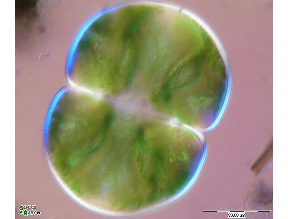 Cosmarium pachydermum