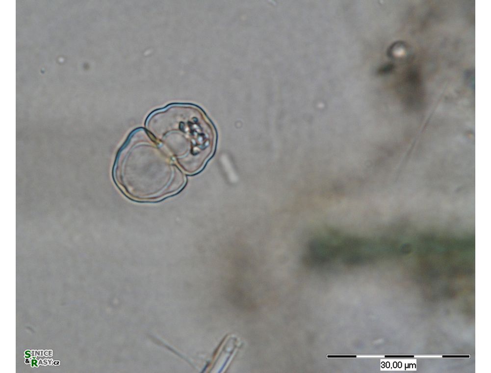 Cosmarium paragranatoides