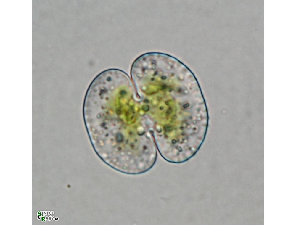Cosmarium phaseolus