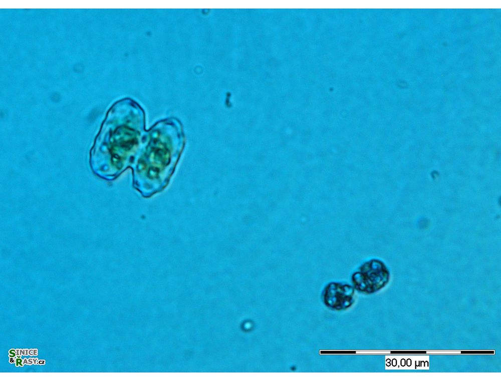 Cosmarium prominulum