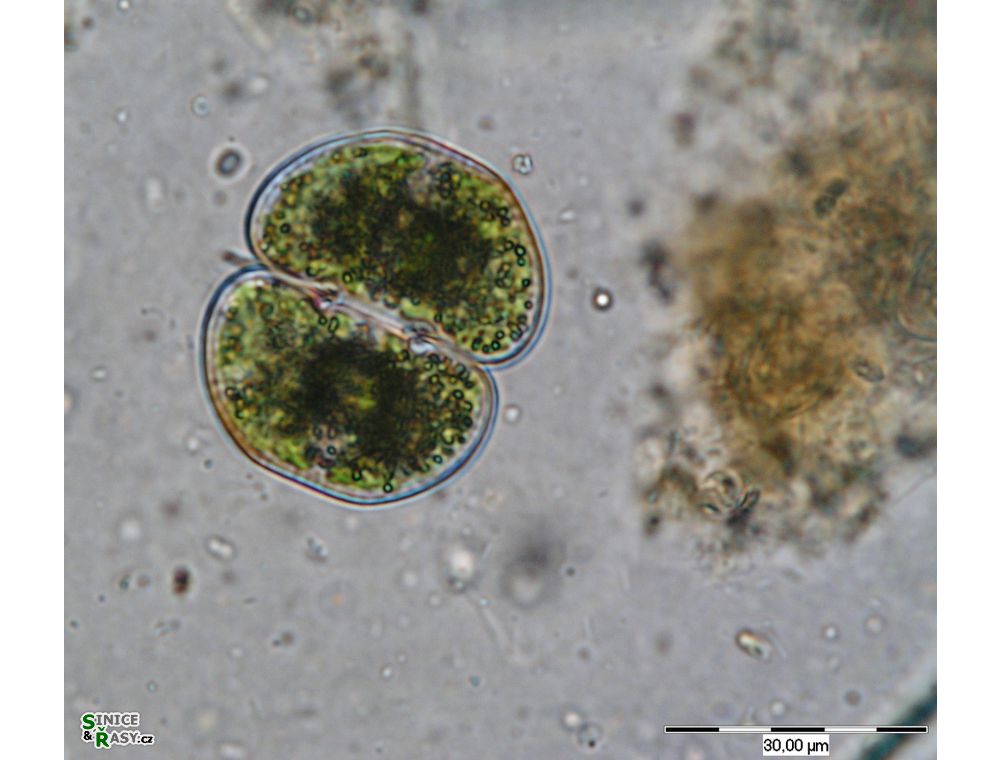 Cosmarium pseudonitidulum